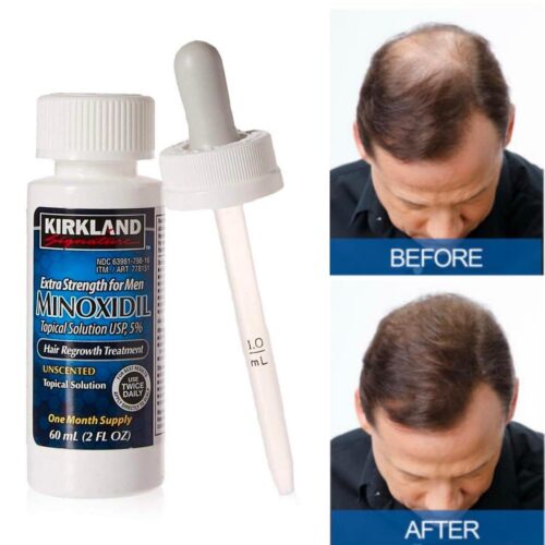 Minoxidil para crecer el vello